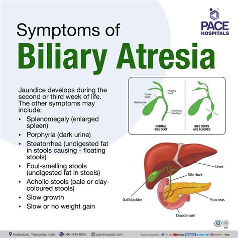 symptoms of bile leak|Biliary Obstruction: Causes, Symptoms, Treatment,。